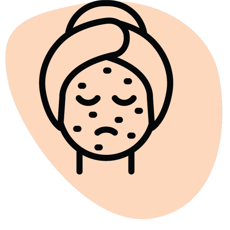 Akne Karşıtı Etki