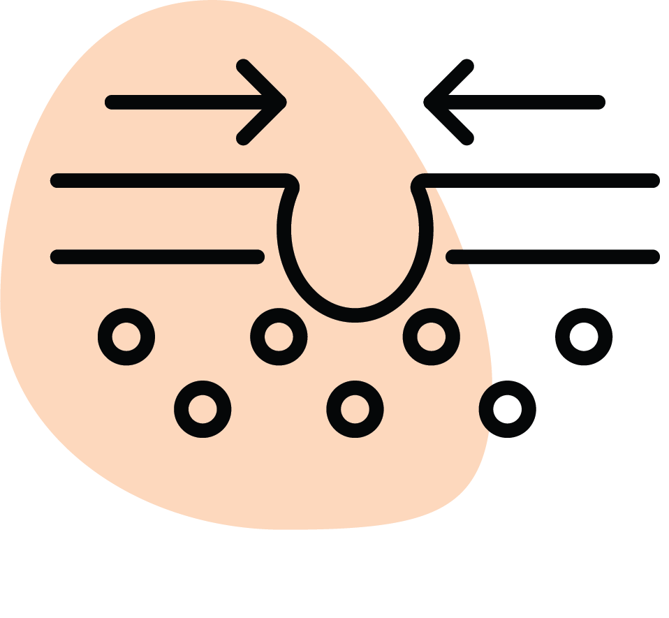 Gözenek sıkılaştırıcı