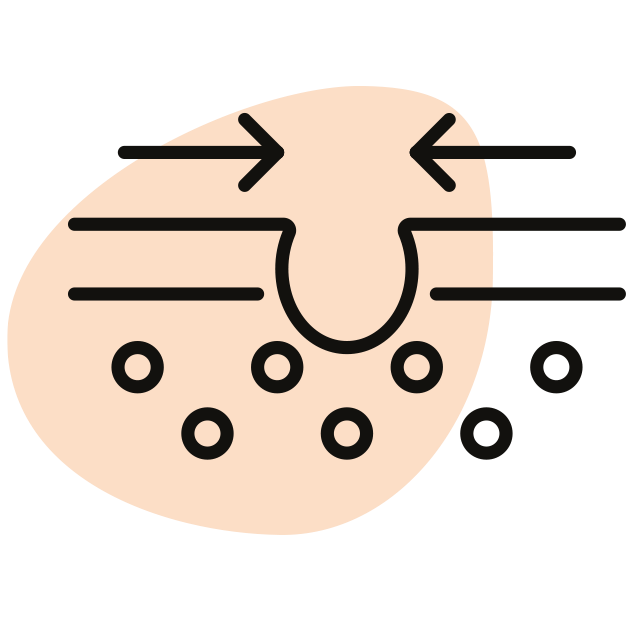 Kırışıklık Önleme