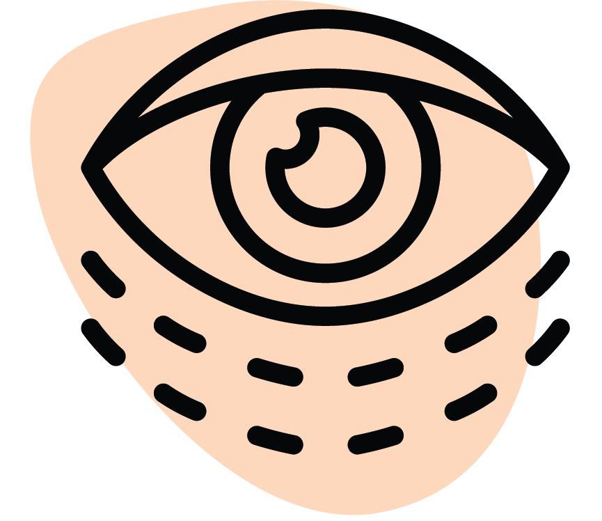 Şişlik ve Ödem Azaltma